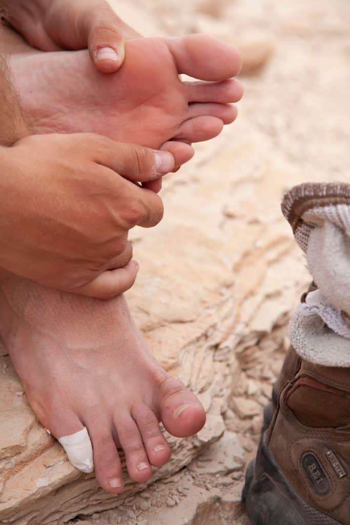 Taking care of injured feet on a river trip